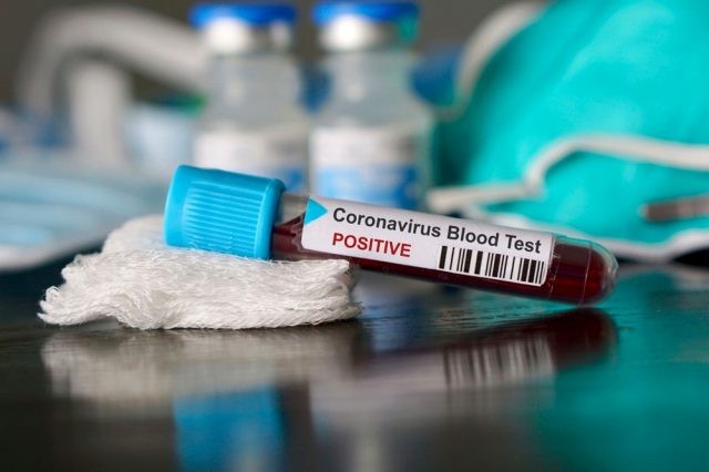 İtaliyada koronovirusdan ölənlərin sayı artdı