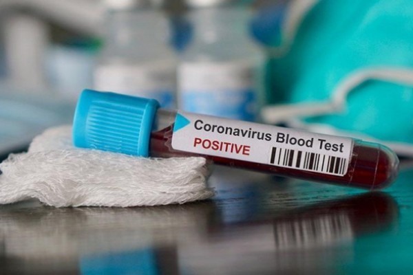 Azərbaycanda koronavirus nümunəsi götürən aparatlar Çindən gətirib? 