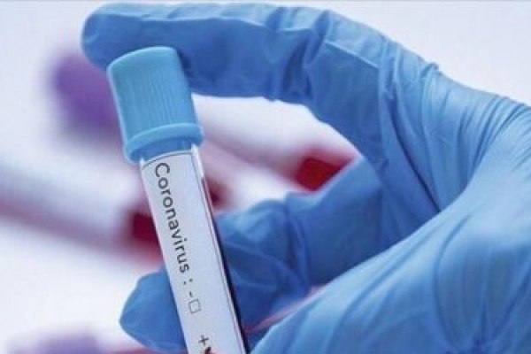 Qırğızıstanda koronavirusa yoluxanların sayı 506-ya çatdı 