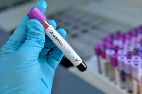 Azərbaycanda 7420 nəfər koronavirus testindən keçib 