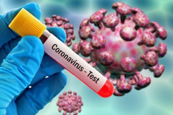 Azərbaycanda daha 338 nəfərdə koronavirus aşkarlandı - 4 pasiyent vəfat etdi