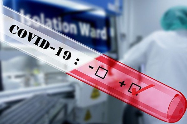 Azərbaycanda daha 438 nəfər koronavirusa yoluxdu - 4 nəfər öldü