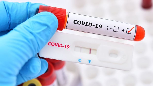 Son sutkada 19 nəfər koronavirusa yoluxub,ölən olmayıb