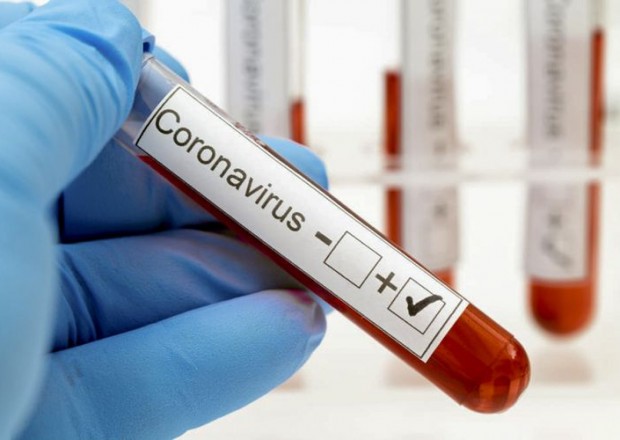 İranda son sutkada 284 nəfər koronavirusdan öldü 