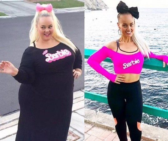 "Barbie" bənzəmək üçün 90 kilo arıqladı  - FOTOLAR