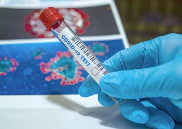 Gürcüstanda son sutkada daha 161 nəfər koronavirusa yoluxub 