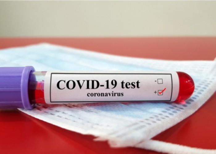 "Koronavirus pandemiyasının sonu yaxınlaşır" - ÜST