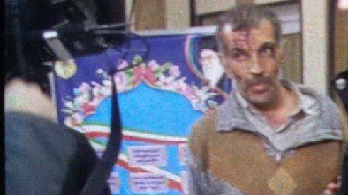 İrandakı səfirliyimizə hücum edən terrorçununFOTOSU