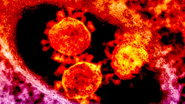 Koronavirusun ən çox mutasiyaya uğramış variantı tapıldı