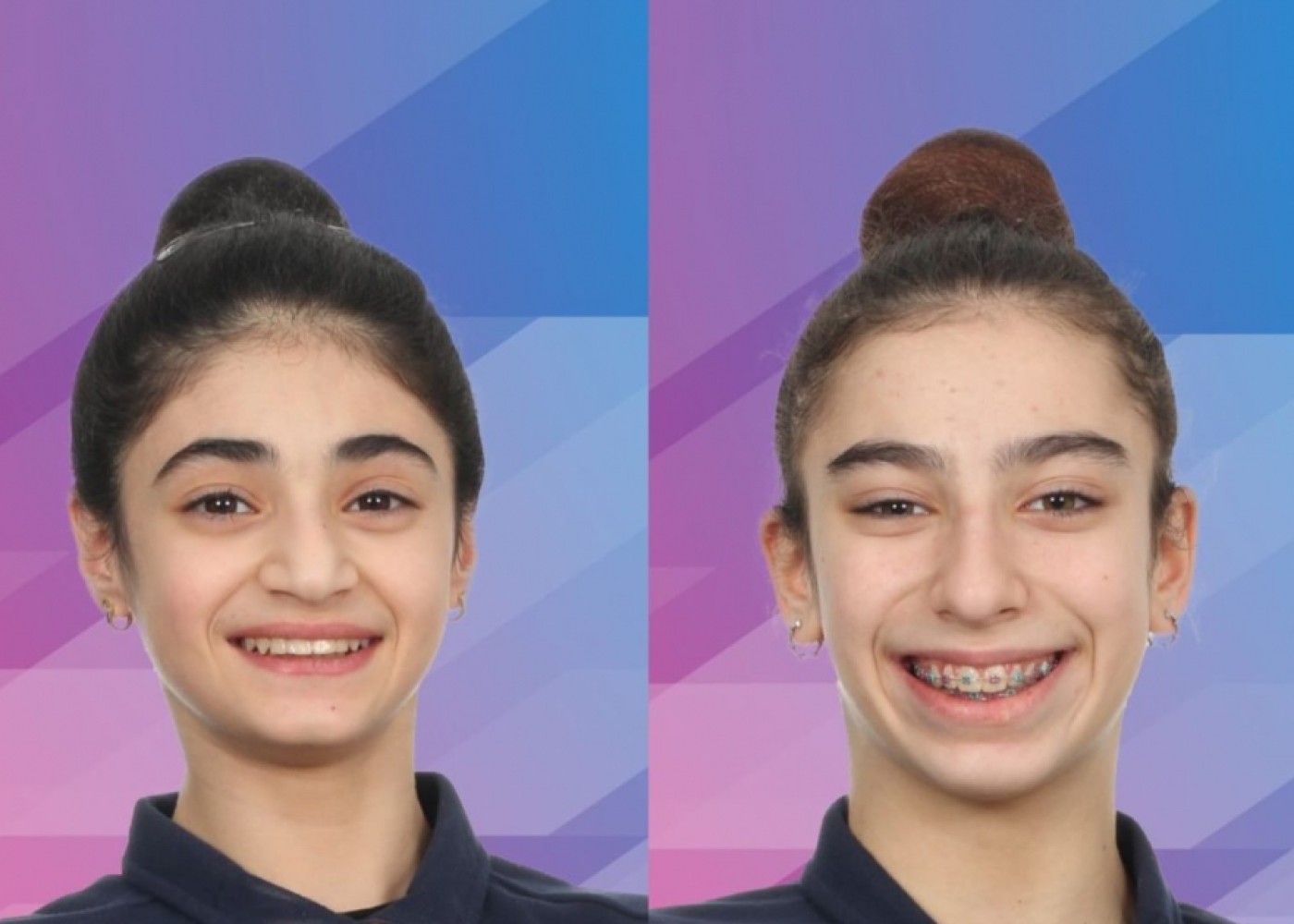 Azərbaycan gimnastları Almaniyada iki medalqazandı