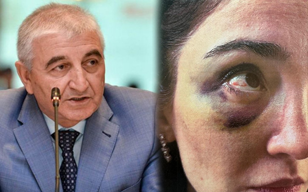 Məzahir Pənahovun oğlu arvadınaişgəncə verib - FOTO Məzahir Pənahovun oğlu arvadınaişgəncə verib - FOTO