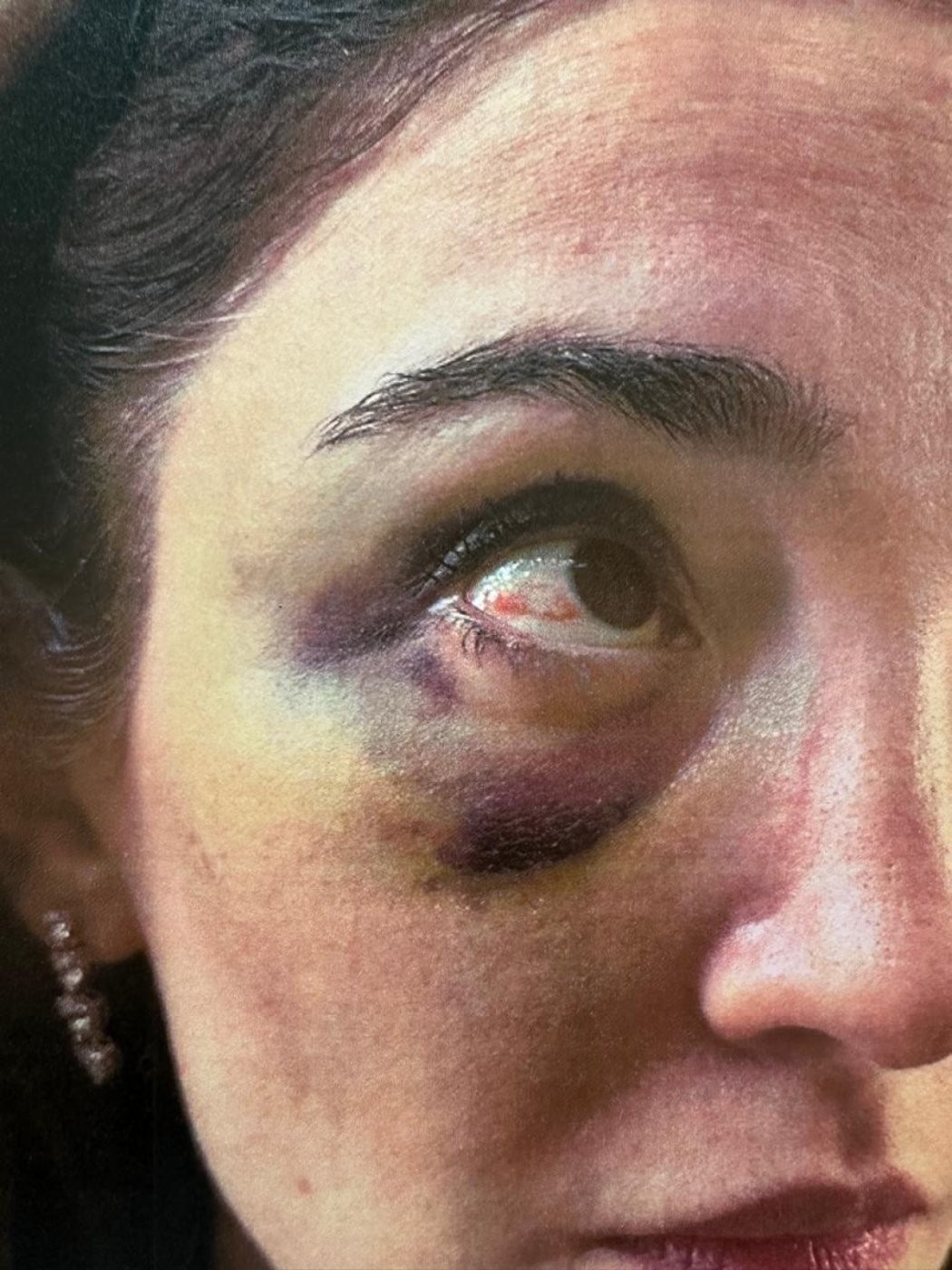 Məzahir Pənahovun oğlu arvadına işgəncə verib - FOTO