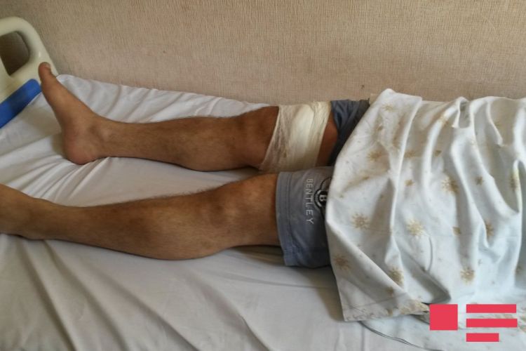 Gəncə iğtişaşında yaralanan polis danışdı  